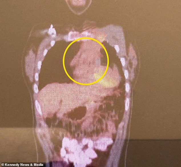 From Stress to Severe Symptoms: The Hidden Health Crisis Behind Persistent Rashes