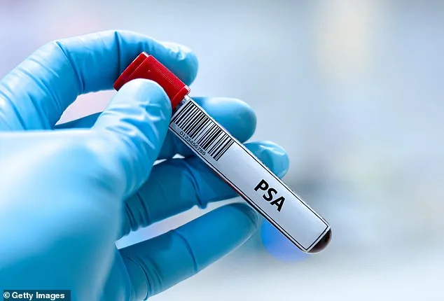 Diabetes Drug Metformin May Cut Prostate Cancer Risk by 35%, Study Finds