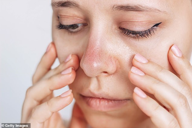 Persistent Cold Nose May Signal Rare Immune Disorder – Unusual Raynaud's Presentation