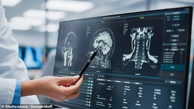 Headaches: When to Worry and 4 Red Flags That Signal Serious Health Risks