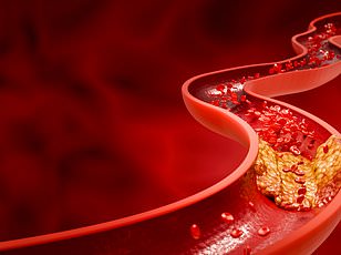 11 Extra Minutes of Sleep Could Cut Heart Attack Risk as Much as Medication, Study Reveals