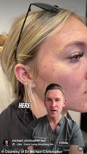 Juliah Thompson, 21, Ignores Mole That Transforms Over Three Months Despite Vigilant Skin Care