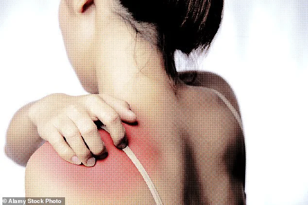 UK Psoriasis Crisis: Addressing Stigma, Misconceptions, and Mental Health Challenges