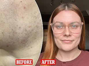 Inexpensive Drug Metformin May Replicate Exercise Benefits, Study Reveals