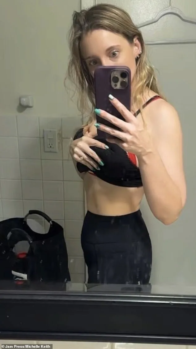 From Mirror to Misdiagnosis: How Lipoedema Changed Michelle Keith's Life