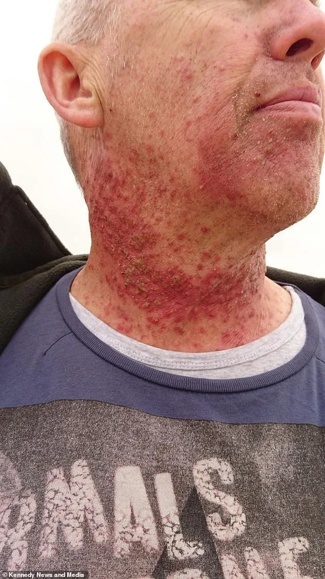 HPV Vaccine Extends Protection to Boys, Slashing Cancer Risk