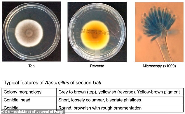 Resilient Fungal Spore Could Survive Journey to Mars and Infect Astronauts
