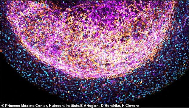 Scientists Preserve Human Brains in Tanks to Study Disease Progression