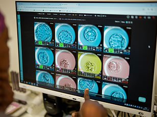 Scientists Preserve Human Brains in Tanks to Study Disease Progression