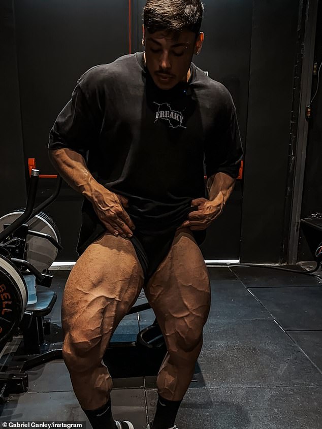 Brazilian Bodybuilder Gabriel Ganley Dies at 22 Amid Hypoglycemia Speculation