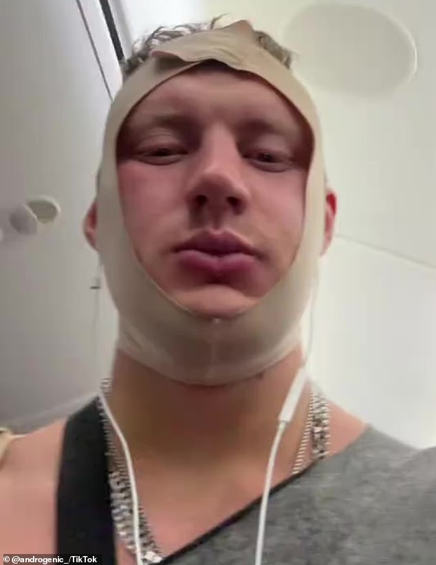 Australian Influencer Ronan Androgenic Evicted From Jetstar Flight After Plastic Surgery