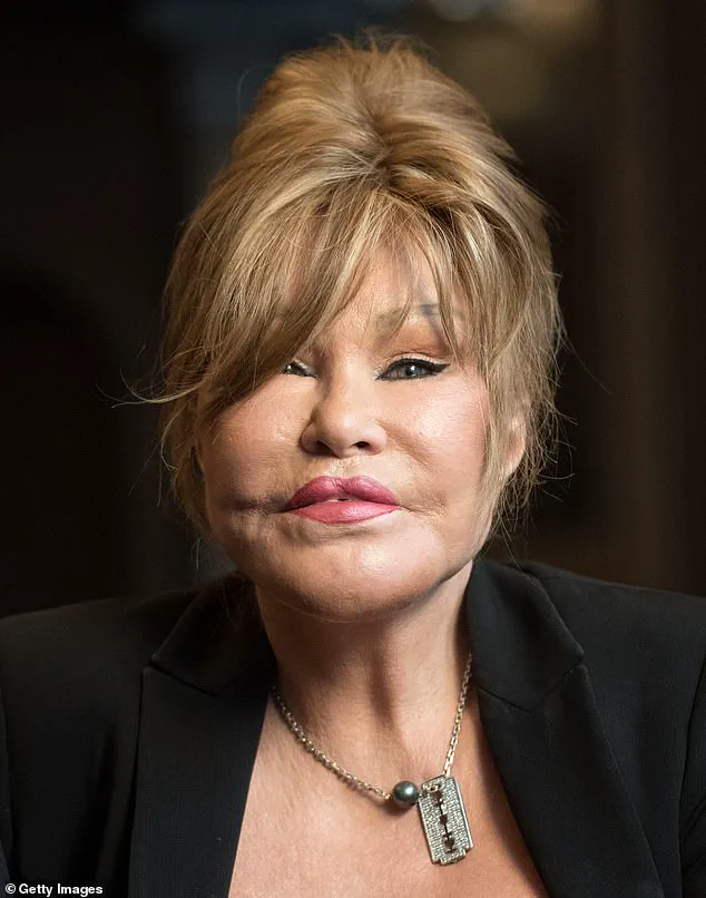 The True Story of Jocelyn Wildenstein's Life and Love for Alec