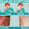 Frontline Doctors Sound Alarm as Measles Outbreak Devastates Texas Town