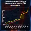 Low-Carb Diets Linked to Increased Risk of Colon Cancer: New Study Reveals Concerning Health Risks
