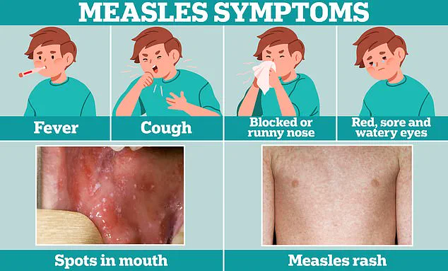 Washington D.C. Health Officials Issue Alert After Measles Case at Multiple Public Locations