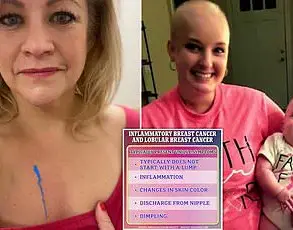 Young Mother's Breast Cancer Battle Ignored by Doctors for Two Years