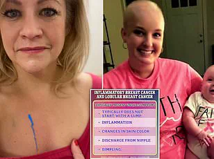 Young Mother's Breast Cancer Battle Ignored by Doctors for Two Years