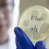Alarming Surge in Deadly E. coli Strain Linked to Colon Cancer