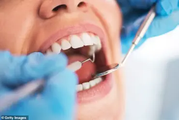 NHS Faces Critical Dentist Shortage as Vacancies Far Outnumber Practitioners