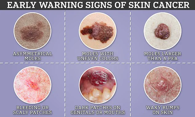 NHS Top Cancer Doctor Urges Public to Watch for Early Signs of Illness