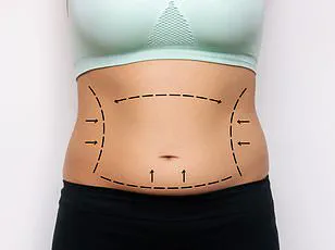 Social Media Reacts to Transformation of Woman Who Lost Over Half Her Body Weight with Ozempic