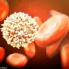 Statins May Cut Risk of Deadly Blood Cancer by Two-Thirds, Study Suggests