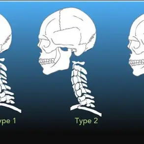 Surviving the Rare Horror: One Man's Battle Against Internal Decapitation