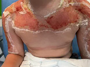 Exclusive: Inside the Medical Emergency That Transformed a New Yorker's Face in the Dominican Republic