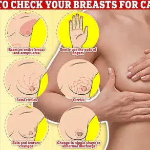 Urgent Policy Shift: NHS Expands Breast Cancer Screening to Women in Their 30s as Data Reveals Over 10,000 Annual Diagnoses Under 50