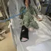 Harrowing Medical Ordeal: Mother Loses All Limbs to Rare Complication from Winter Infections