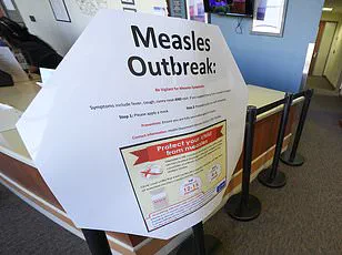 Texas Mother's Measles Ordeal Highlights Underreported Outbreak and Urgent Public Health Advisories