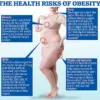 Over 100 Million Americans at Risk of Reclassification as Obese Under New Global Standards, Sparking Health Policy Debate