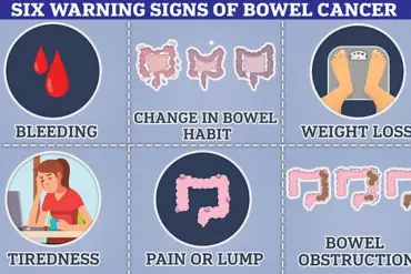 Rising Bowel Cancer Cases Among Under-50s Prompt Calls for Routine Screenings