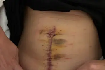 Early Signs, Hidden Dangers: The Critical Role of Expert Advisories in Public Health