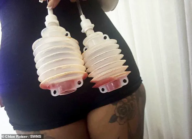 Late-Breaking: Nurse Chloe Roiser's Medical Emergency in Antalya After Botched Procedure