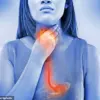 The Acid Reflux Treatment Debate: Is the Go-To Drug Under Scrutiny?